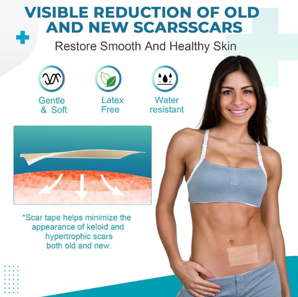 Maviglow® Silicone gel self-adhesive scar patch