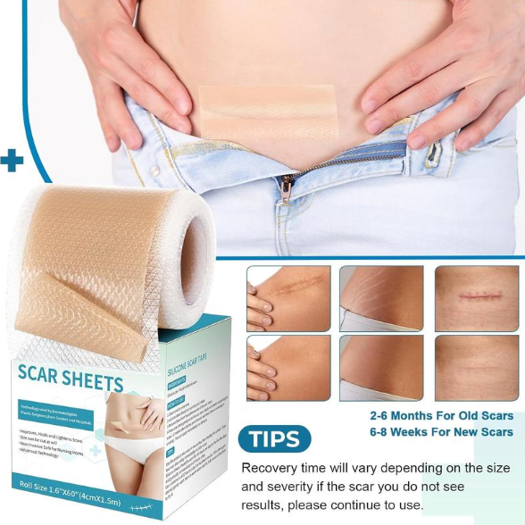 Maviglow® Silicone gel self-adhesive scar patch