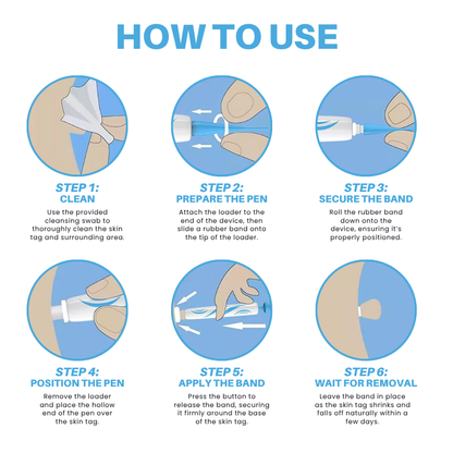 Painless At-home Skin Tag Removal Pen