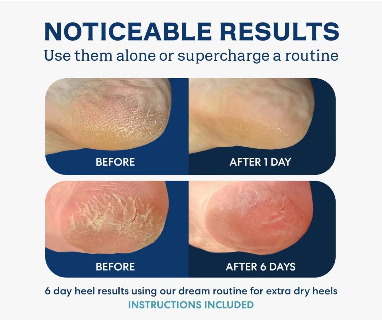 Moisturizing Gel Heel Sock