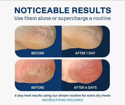 Moisturizing Gel Heel Sock