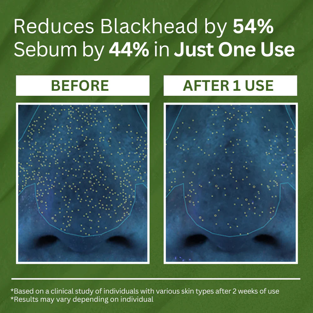 Holy Basil Sparking Bubble Mask-Limited Time 75%OFF 🔥LAST DAY⏰