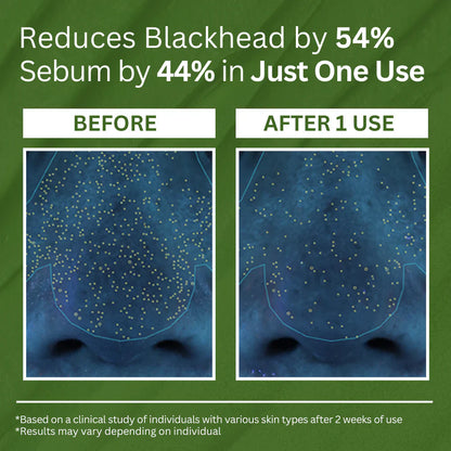 Holy Basil Sparking Bubble Mask-Limited Time 75%OFF 🔥LAST DAY⏰