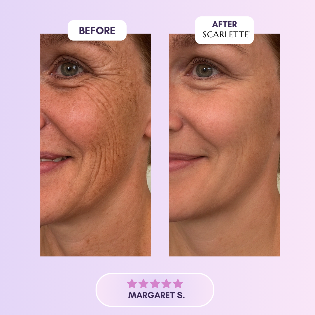  Silicone Collagen Sheets