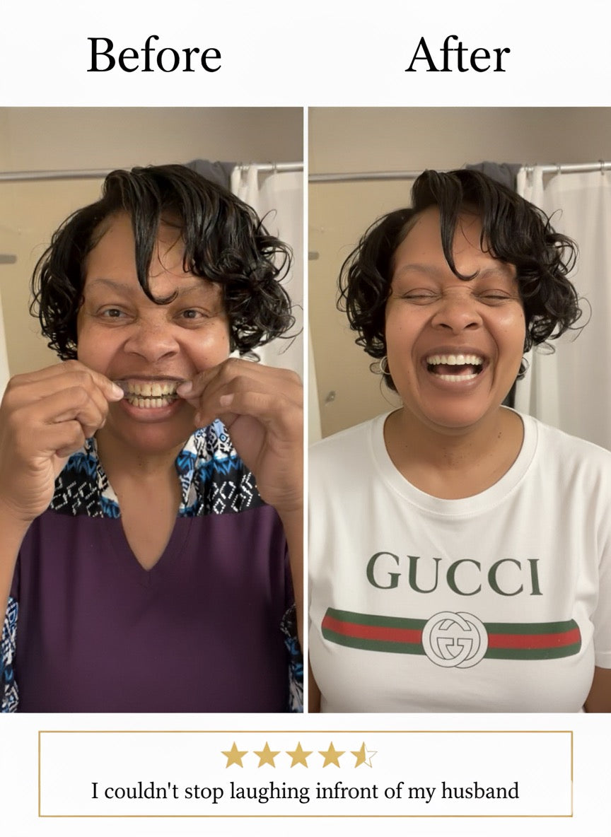 Whitening Strips 7 Day Smile Makeover
