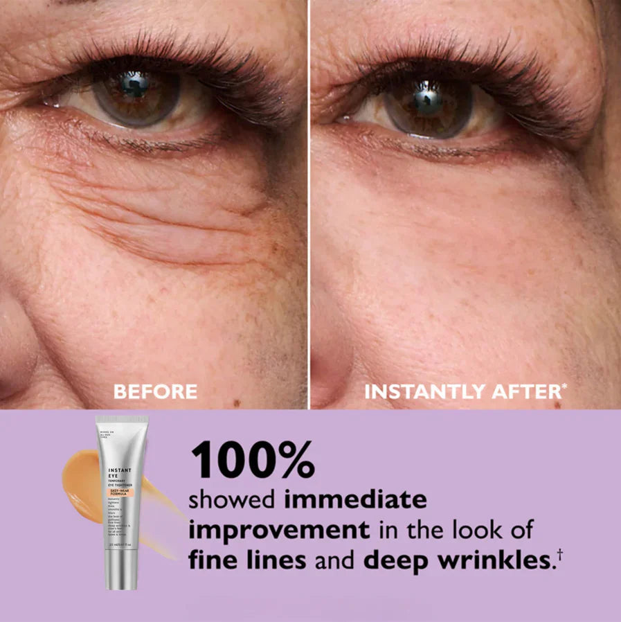 Skin Tightener Cream