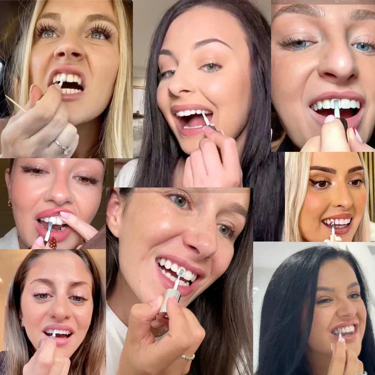 Smileasego™ Tooth Whitening - Instant Clean Smile