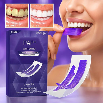 WhiteSmile Teeth Whitening Strips (14 Strips)